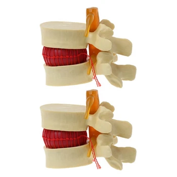2X Lomber Vertebra Modeli Anatomik Omurga Lomber Disk Hernisi Anatomi Öğretim Aracı Lomber Vertebra Modeli